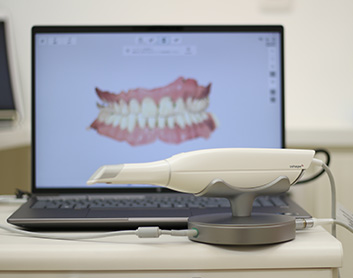 細部まで精密に読み取れる次世代型の「光学印象」