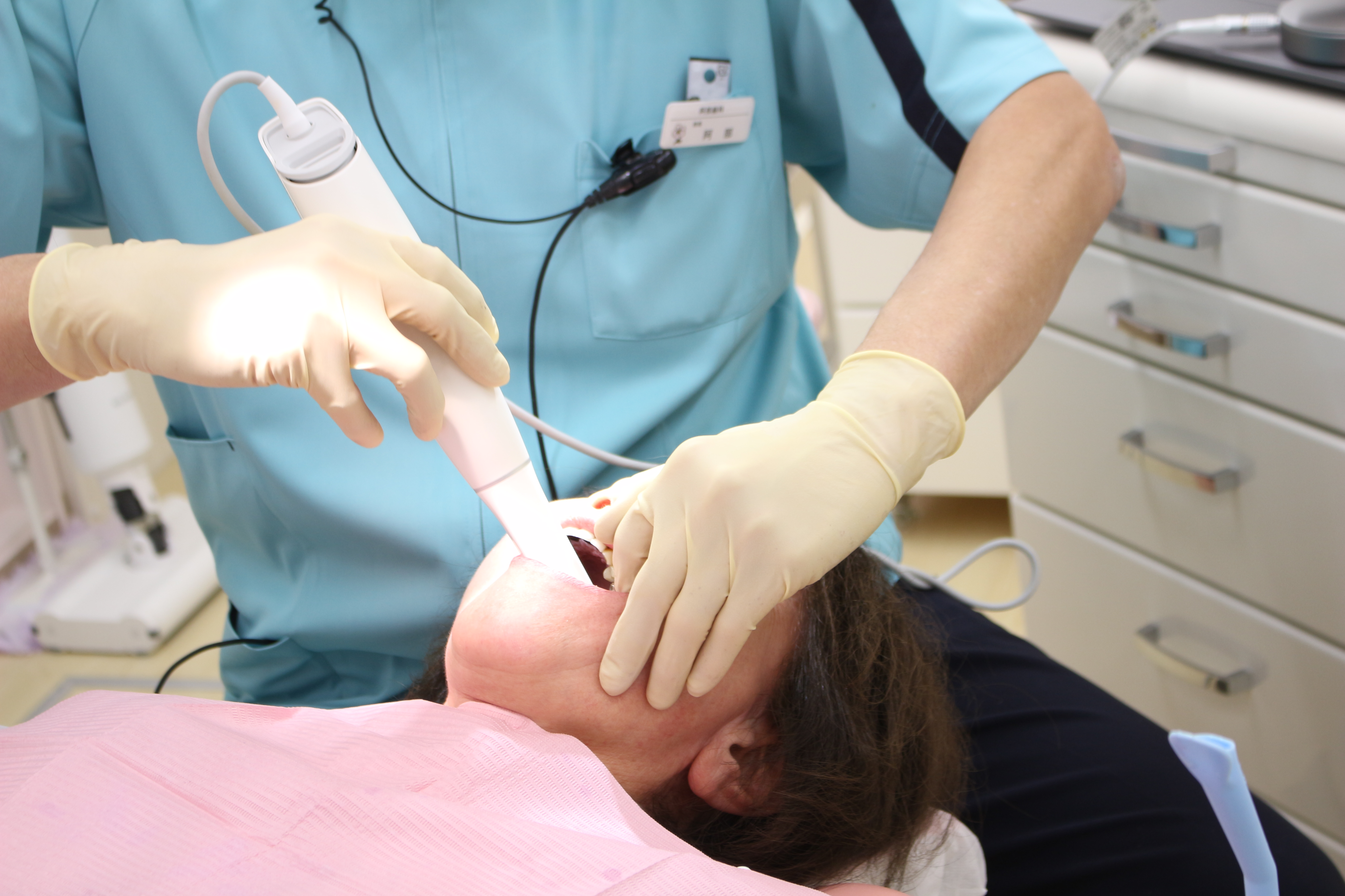 口腔内スキャナーでのスキャン風景